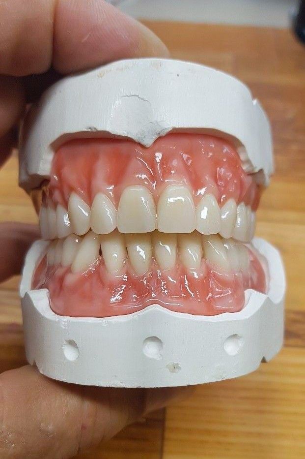 Mitos e Verdades Sobre Prótese Dentária: Descubra o Que é Real!